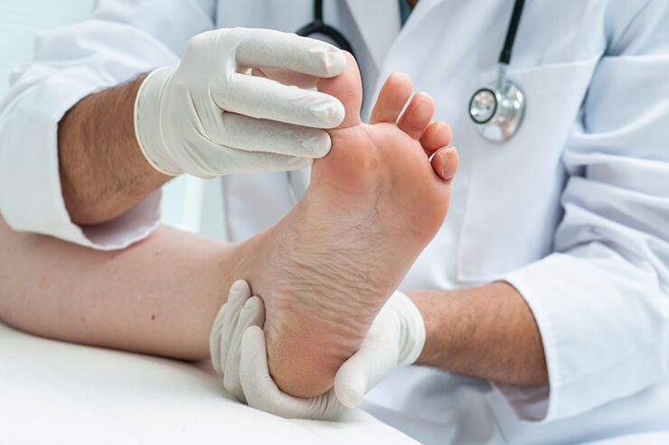 dermatólogo examina las piernas del paciente