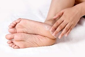 tratamiento de la crema de hongos en la piel del pie
