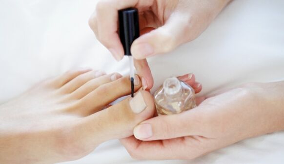 La aplicación de esmalte de uñas medicinal es un procedimiento diario obligatorio durante el tratamiento de hongos. 